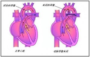 呵护生命，从心开始