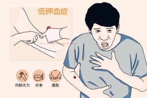经常四肢无力？小心被低钾血症要了命！