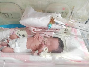 我院成功开展新生儿有创呼吸机的应用 为新生命保驾护航