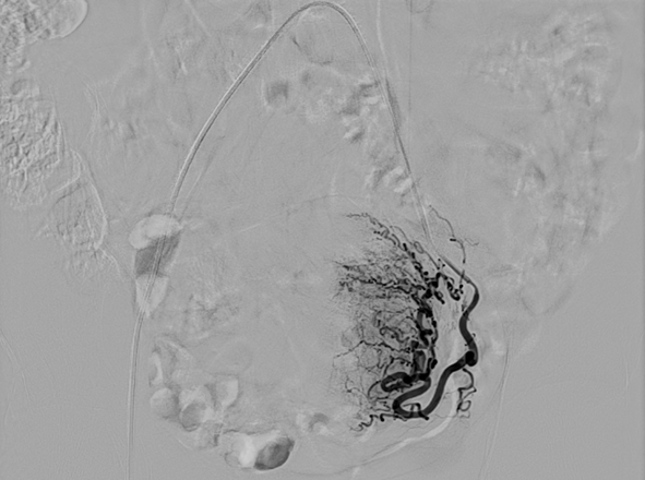 宁南县人民医院