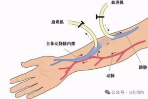 炎炎夏日，血透患者做好这几步，安然度夏无忧愁