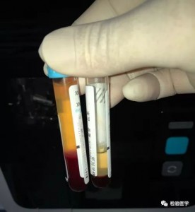 常见的标本拒收问题