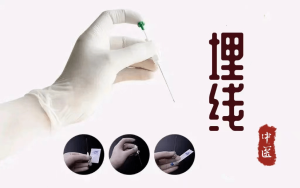 穴位埋线减肥——宁南县人民医院为您制定专业减重方案