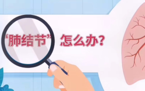 “肺上的小影子”——肺结节
