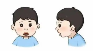 别等孩子变丑了才来后悔 ——你家孩子有以下症状吗？