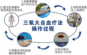 三氧自体血疗法：疼痛科的“绿色新武器”，以己之血，治己之病！